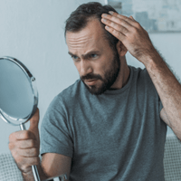 Hair Loss Affiliate Programs